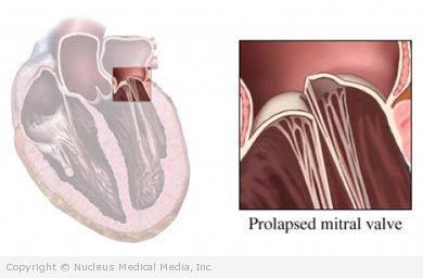 valvular heart test treatment Description, Marfan  Syndrome diagnosis,